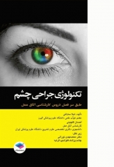 تکنولوژی جراحی چشم ساداتی و گلچینی