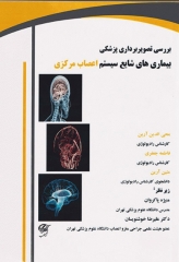 بررسی تصویربرداری پزشکی بیماری‌های شایع سیستم اعصاب مرکزی