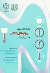 مشکلات پیچ در پروتزهای دندانی متکی بر ایمپلنت