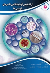 از تشخیص آزمایشگاهی تا درمان لوسمی‌ها