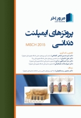 مرور آخر پروتزهای ایمپلنت دندانی کارل میش 2015